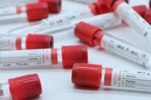 Hospital Provincial Marga Marga reforzará atención con nuevo punto de donación de sangre